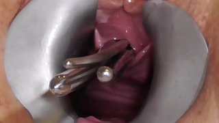 Amatérske FreyjaAnalslut: prúty v Freyja je pisshole